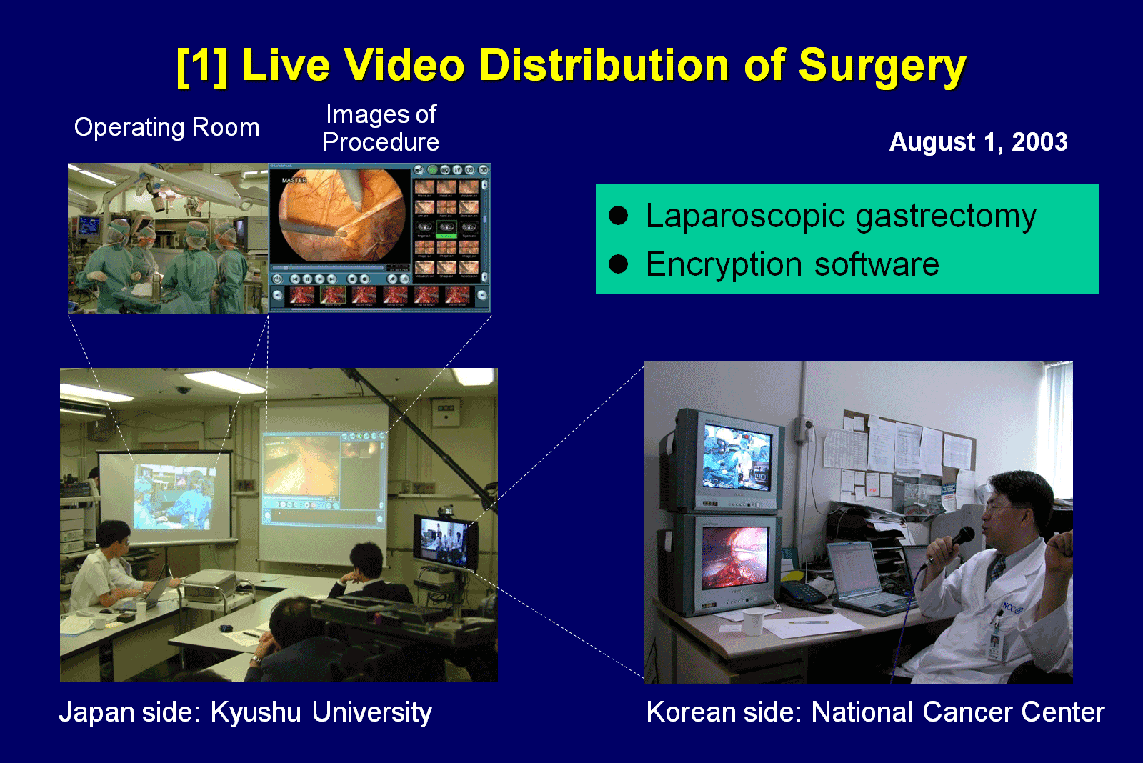 Live Video Distribution of Surgery